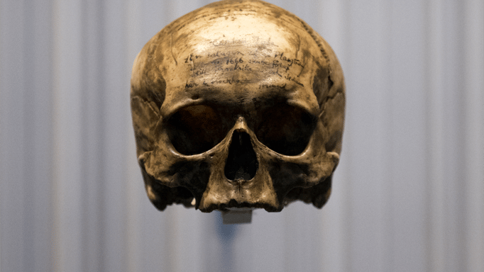 "غرفة جماجم" جامعة إدنبرة.. عنصرية وتجارة رقيق