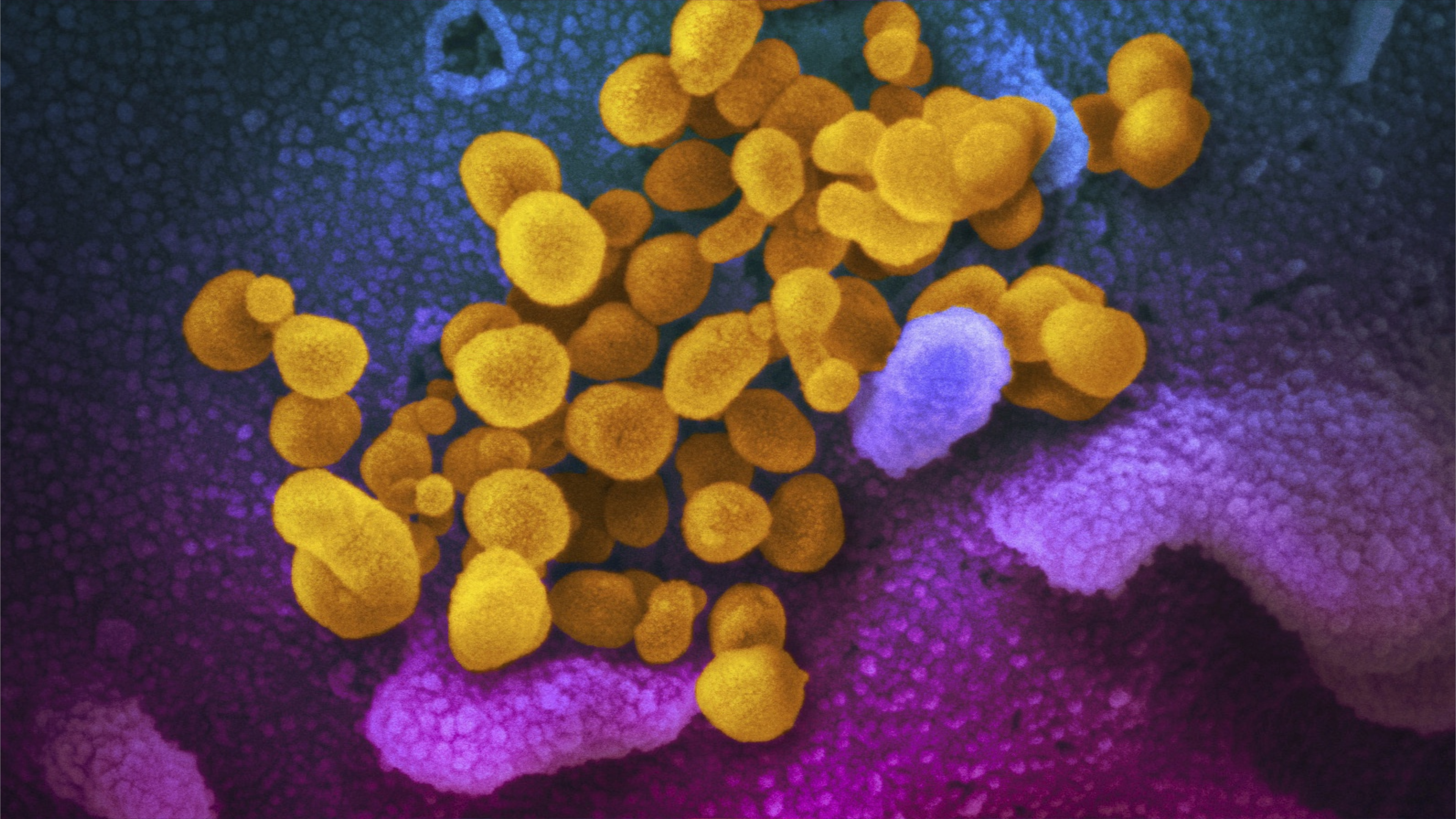 بكتيريا عمرها 5 آلاف تحير العلماء.. مفتاح للأمل أو خطر قاتل؟
