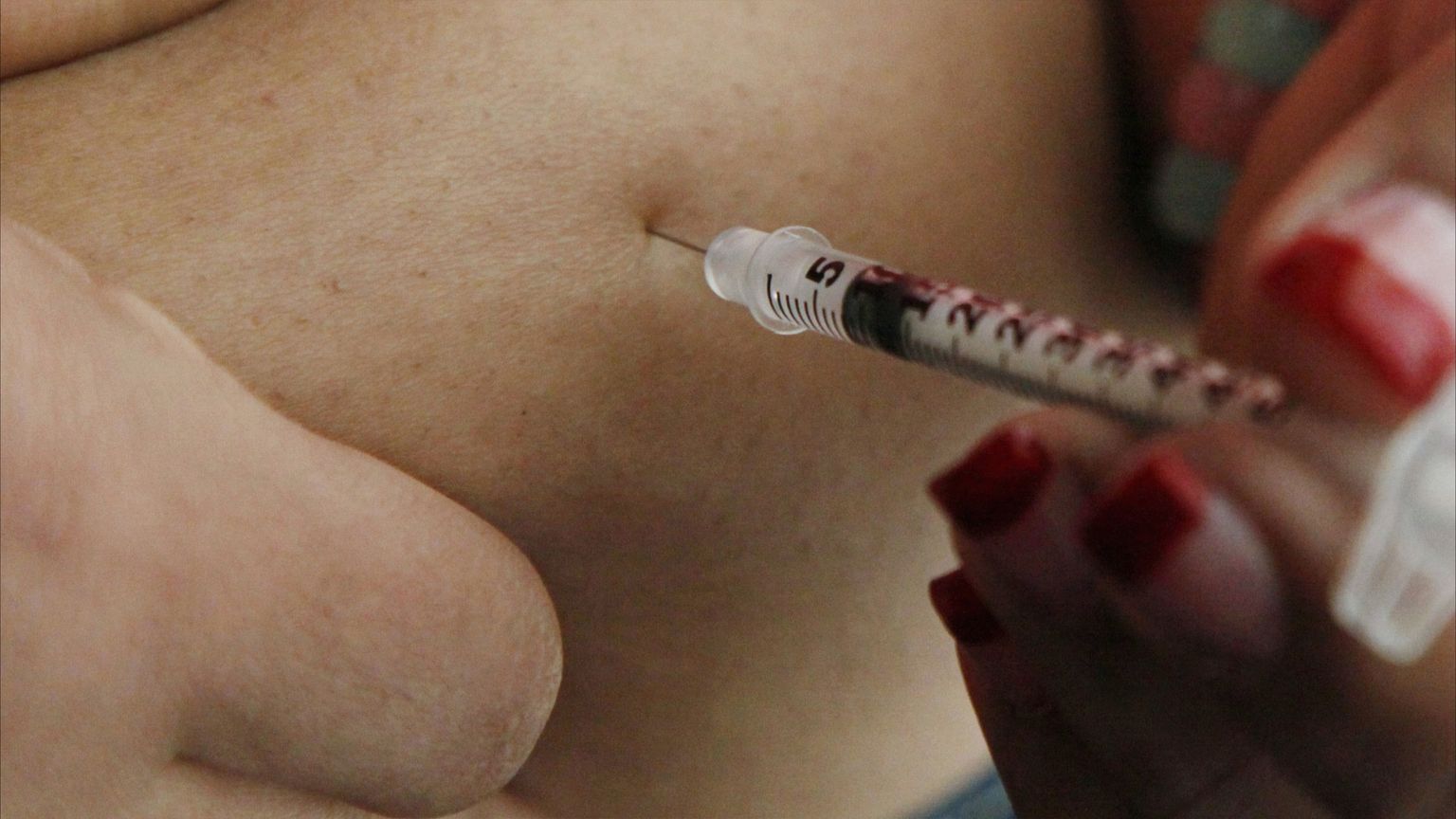 "استعادة سريعة للوزن"؟.. انتبه من حقن التخسيس