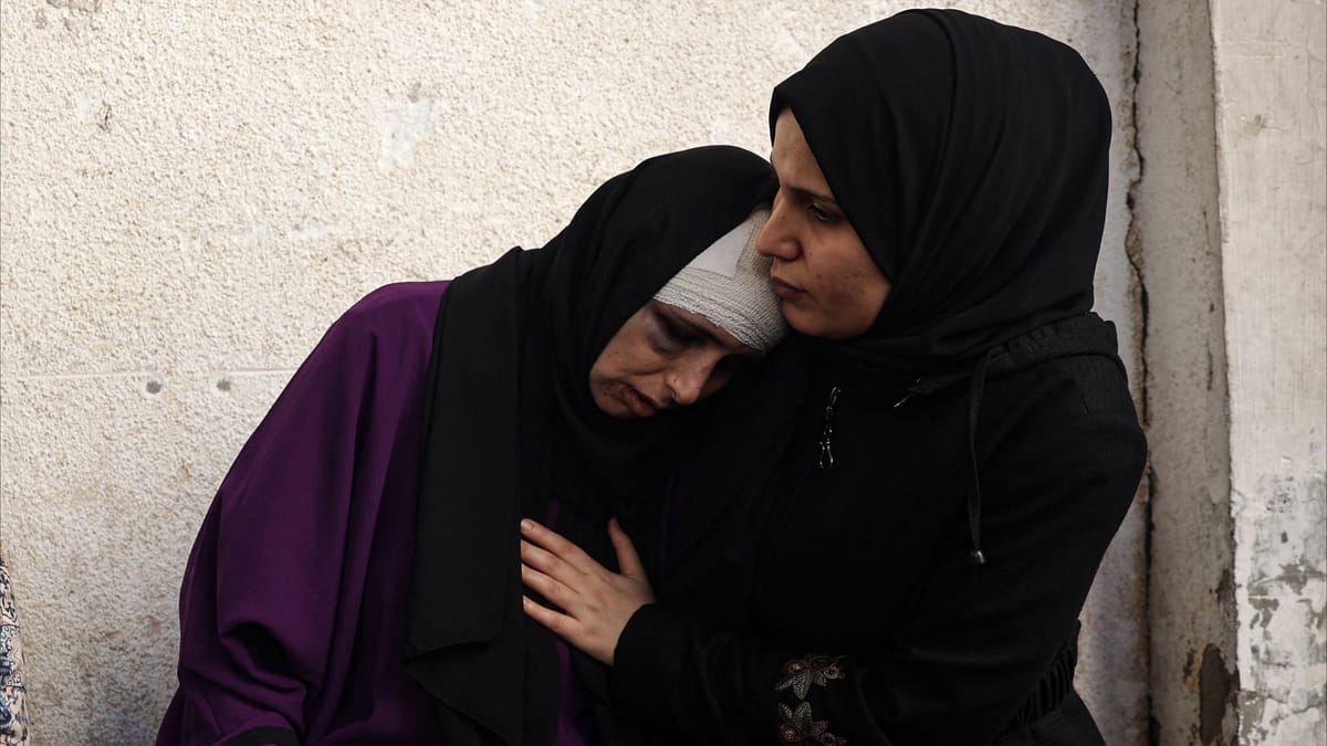 طبيب أميركي يصف عشرات عمليات البتر في غزة