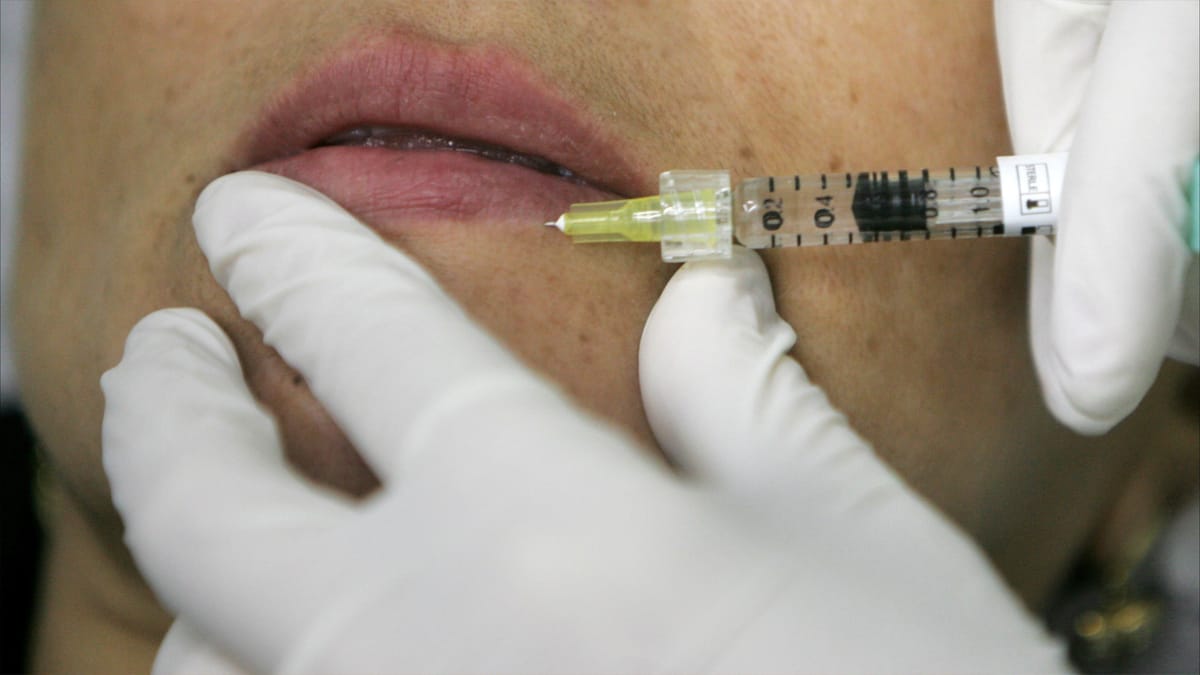 الصين تحذر مواطنيها من جراحات التجميل الكورية