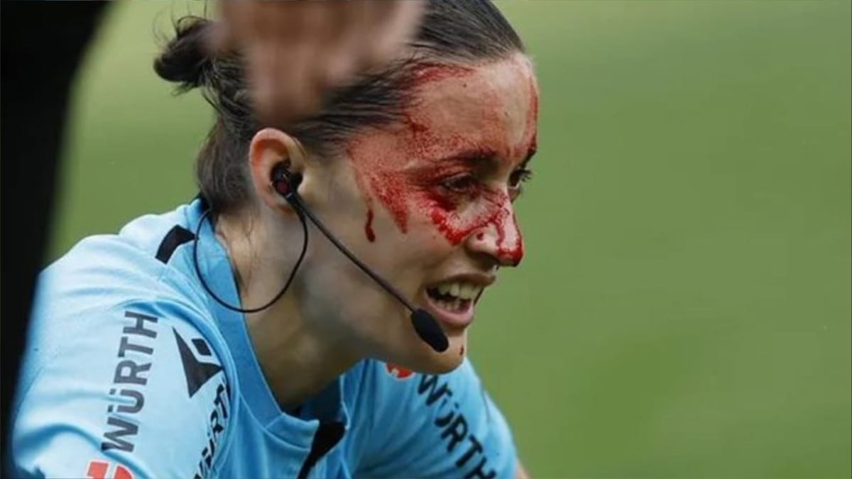 كاميرا "الليغا" تنقل حكمة إلى المستشفى