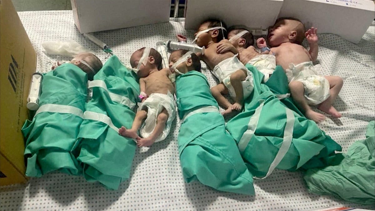 صورة تكشف حجم مأساة أطفال غزة "المبتسرين"