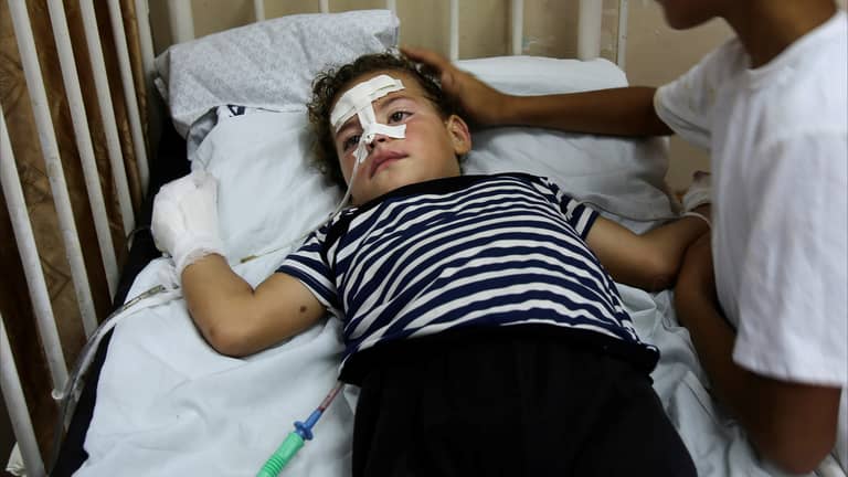 مجموعة من أطفال غزة في إيطاليا لتلقي العلاج