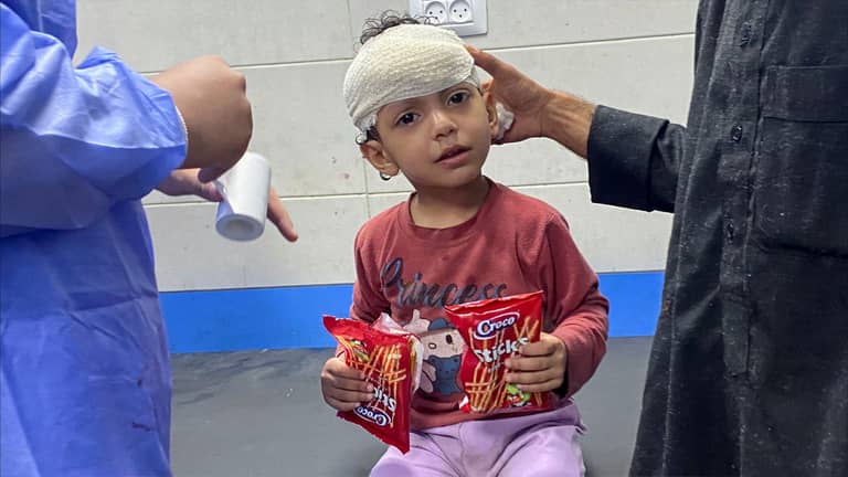 جراحات بدون تخدير.. صرخات ألم تروي معاناة مستشفيات غزة