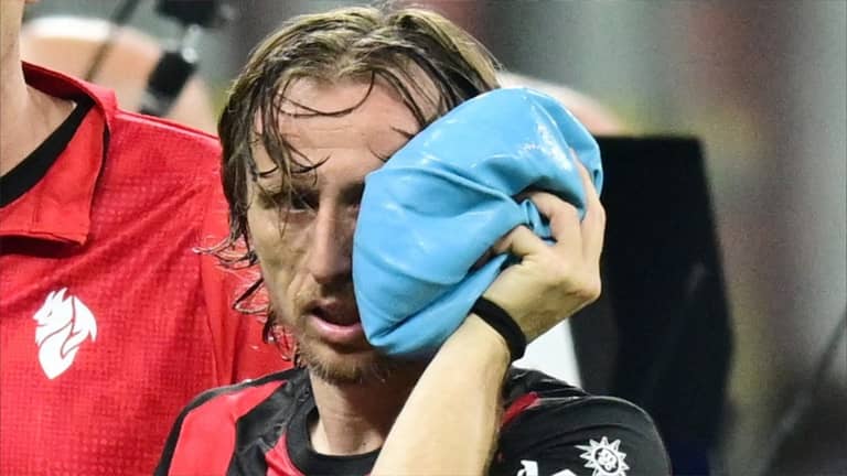 مودريتش يخضع لجراحة قبل المونديال