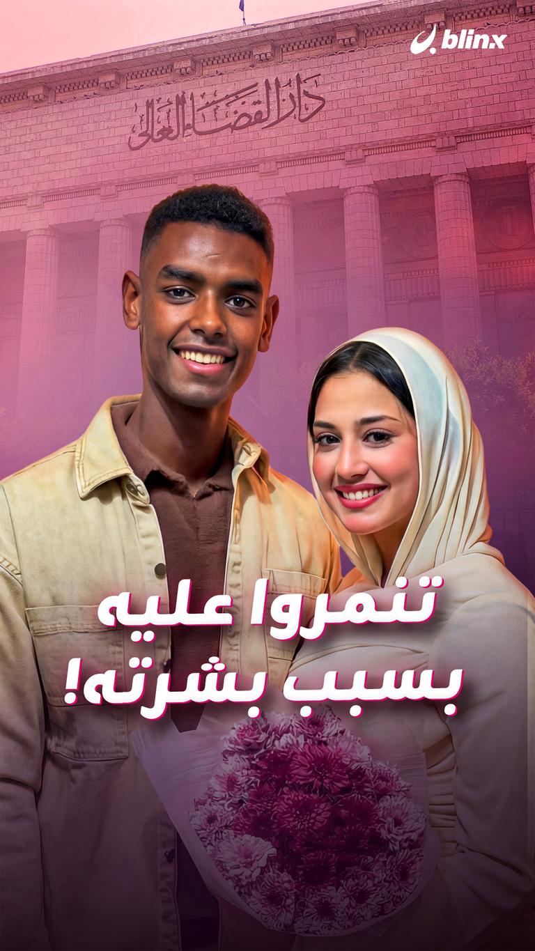 تنمروا عليه بسبب بشرته!