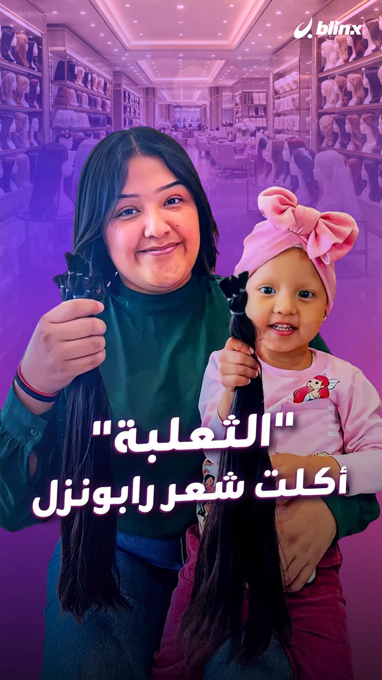 "الثعلبة" أكلت شعر رابونزل