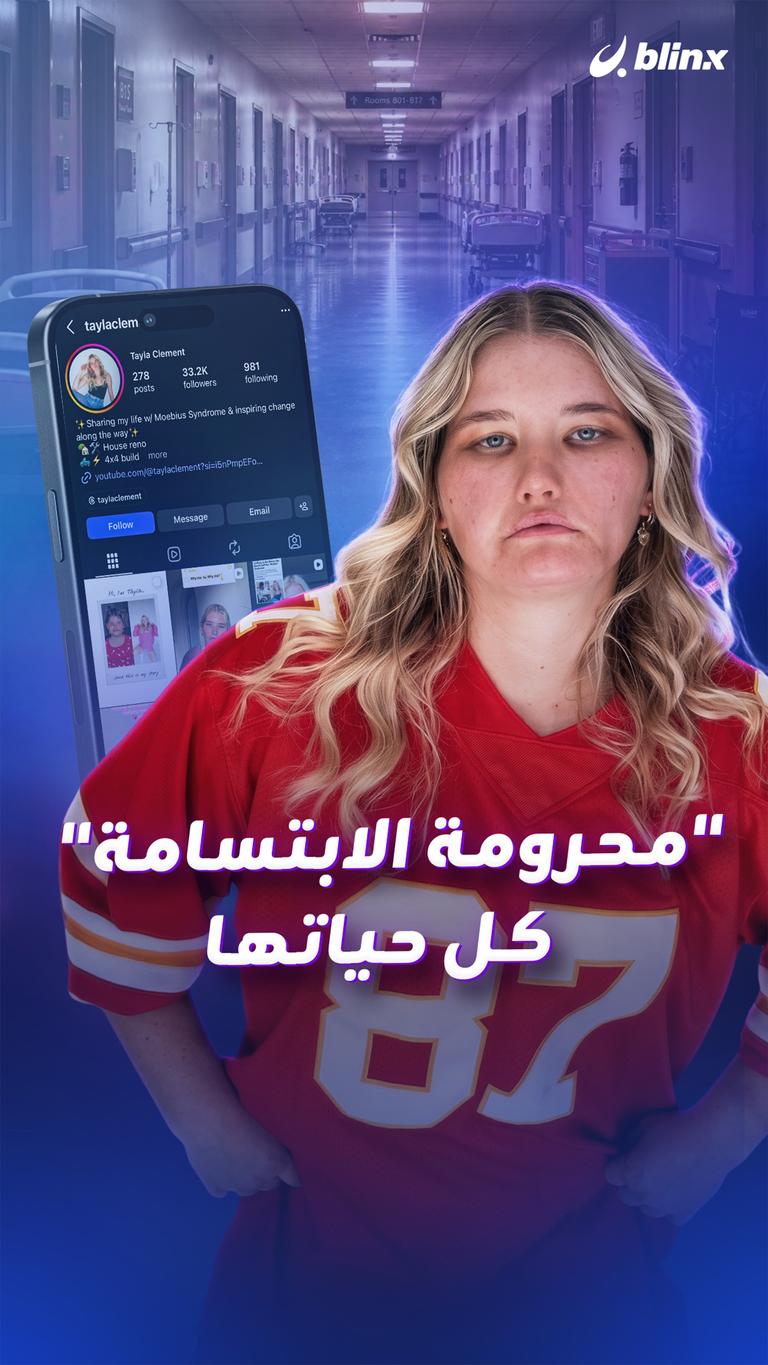 محرومة من الابتسامة كل حياتها