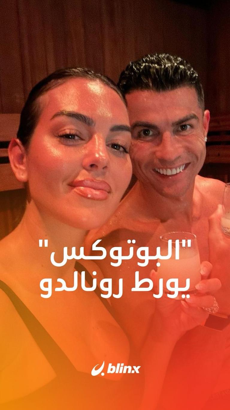 "البوتوكس" يورط رونالدو