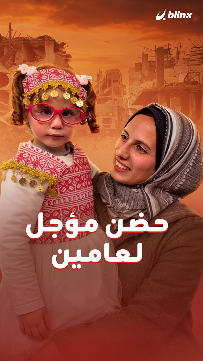 حضن مؤجل لعامين