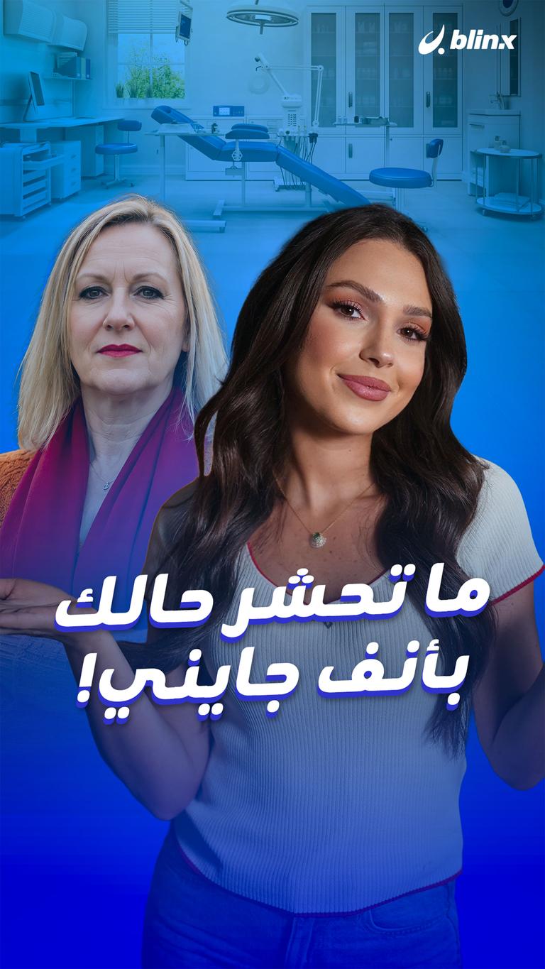 ما تحشر حالك بأنف جايني!