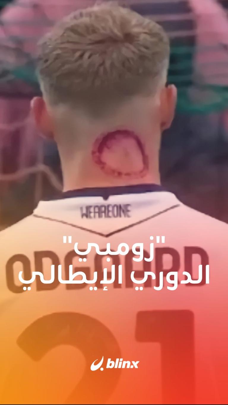 "زومبي" الدوري الإيطالي