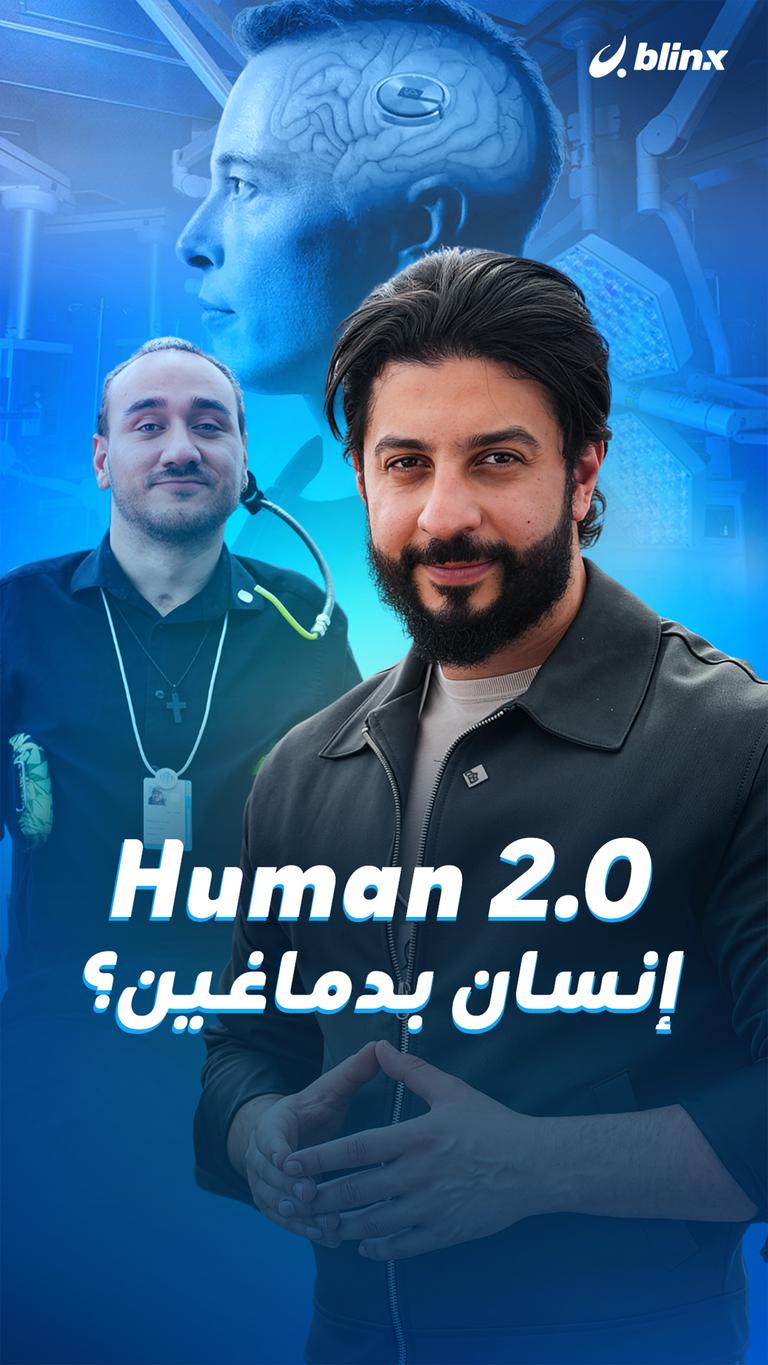 Human 2.0 إنسان بدماغين؟