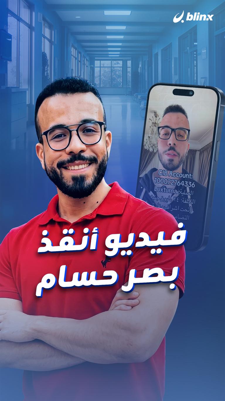 فيديو أنقذ بصر حسام