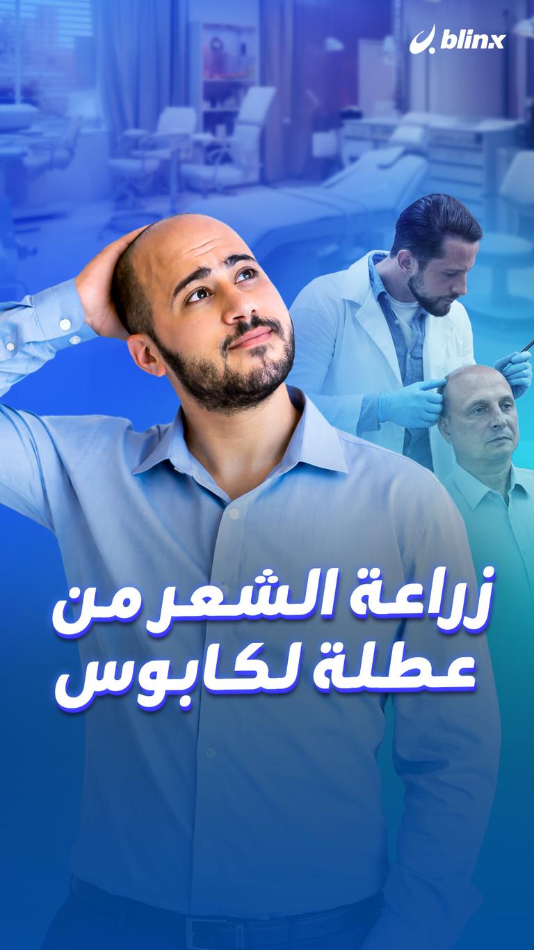 زراعة الشعر من عطلة لكابوس