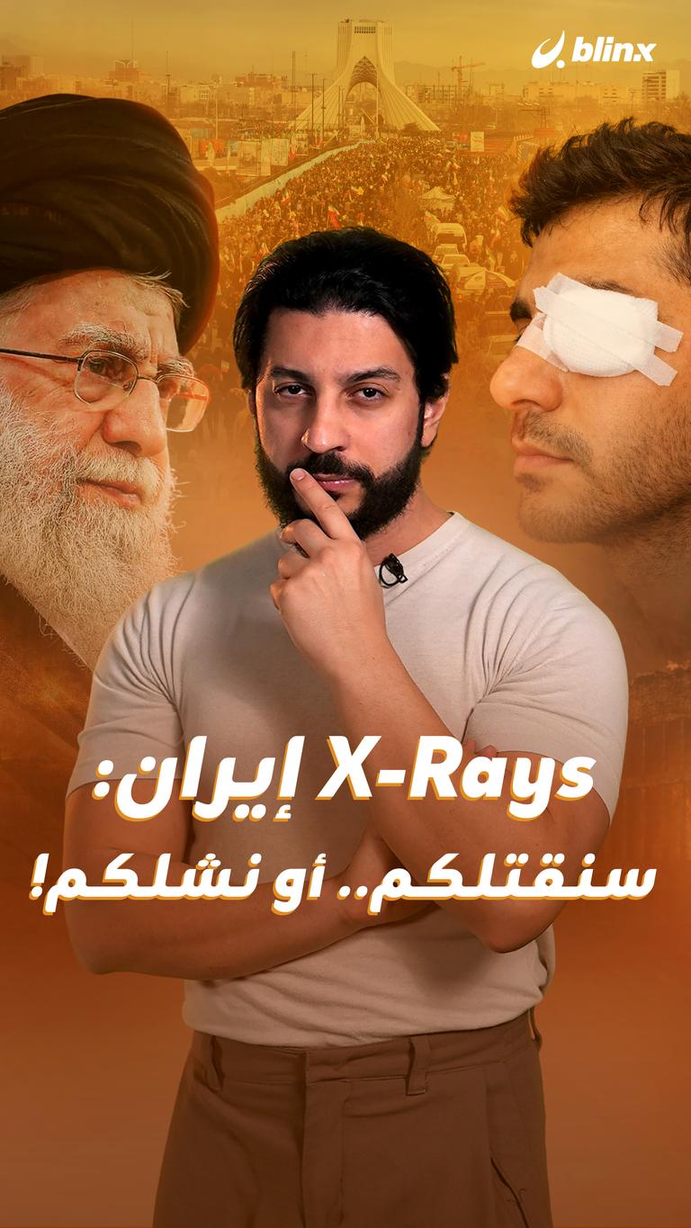 X-Rays إيران: سنقتلكم.. أو نشلكم!