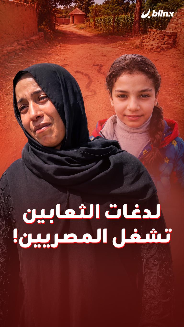 لدغات الثعابين تشغل المصريين!