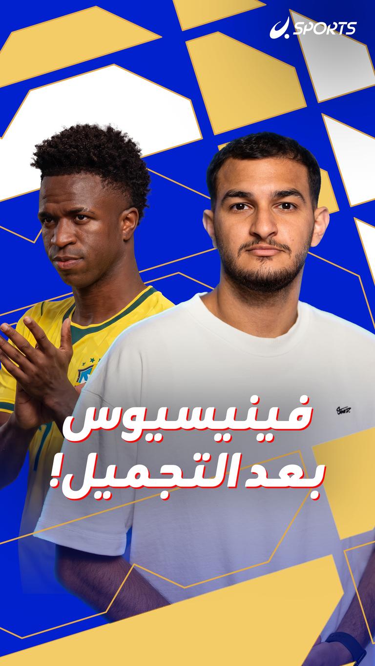 فينيسيوس  بعد التجميل!