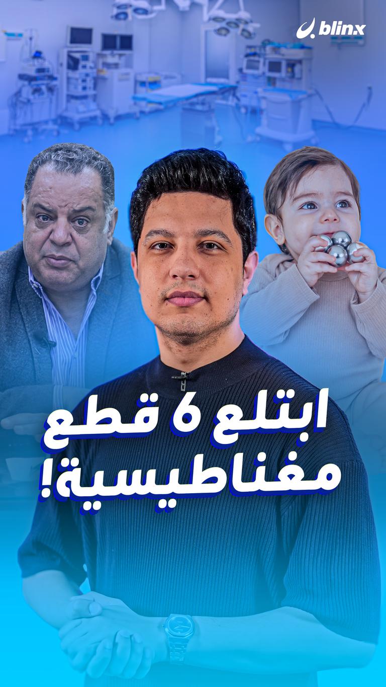 ابتلع 6 قطع مغناطيسية!