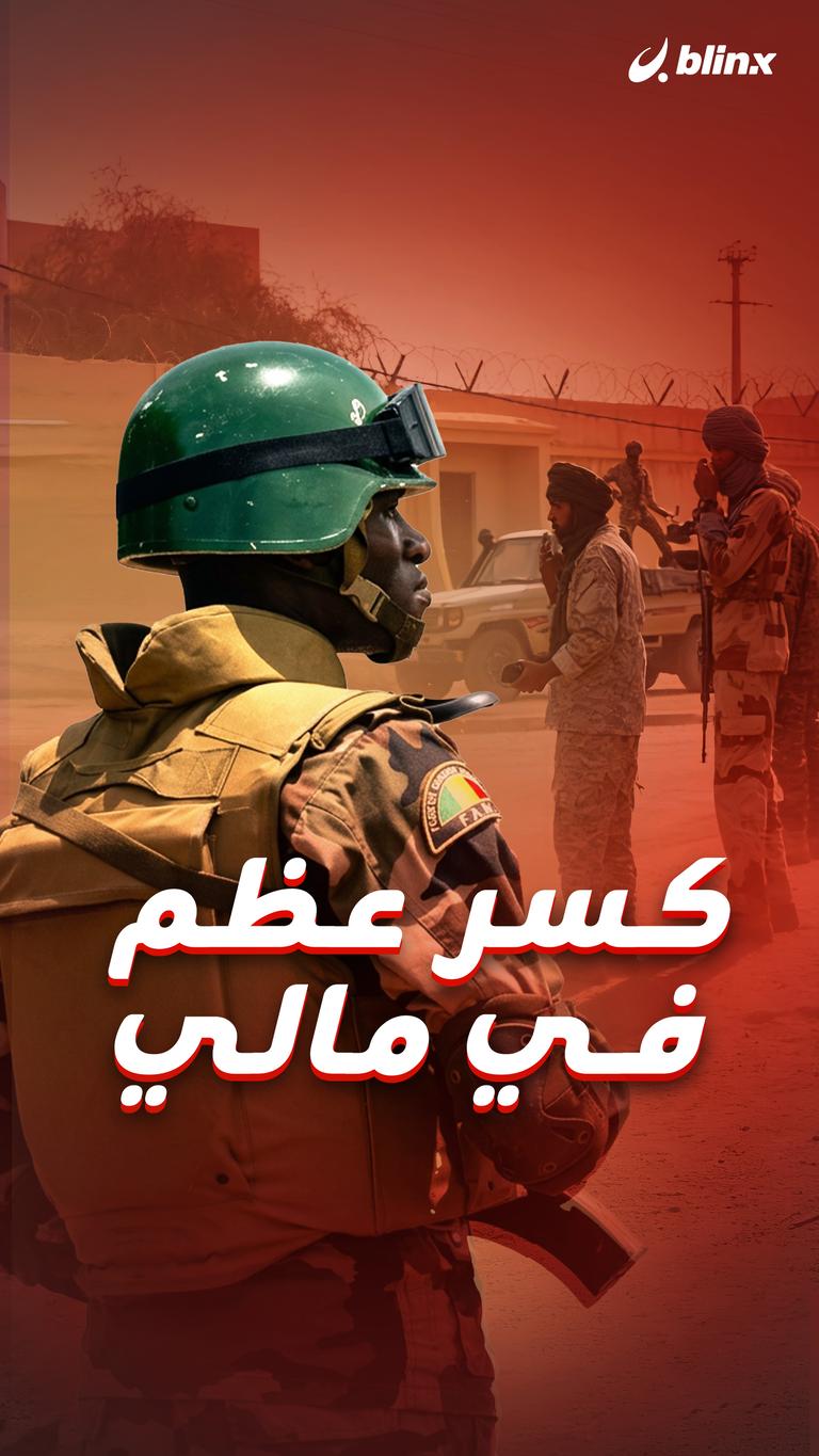 كسر عظم  في مالي