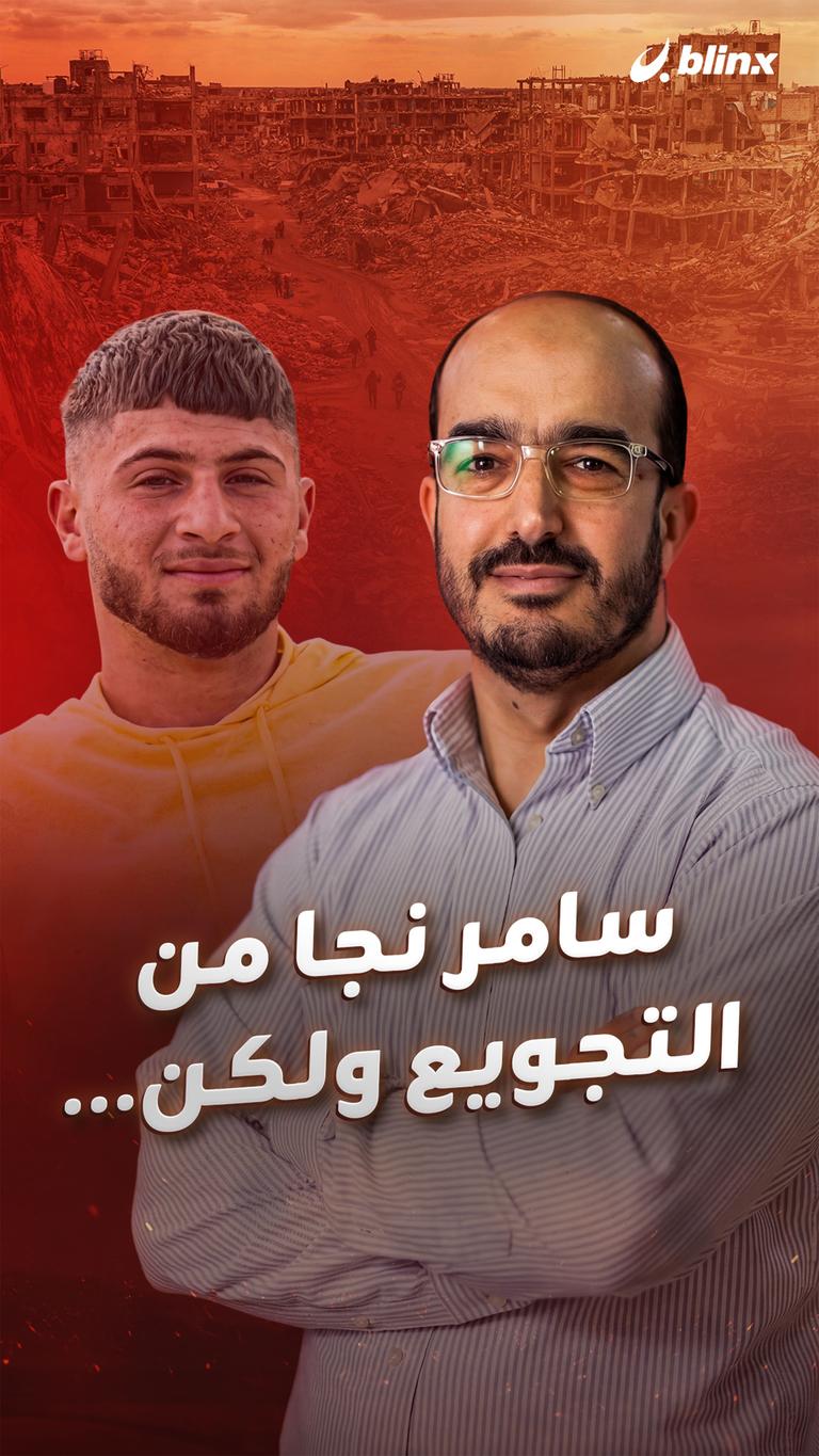 سامر نجا  من التجويع ولكن...