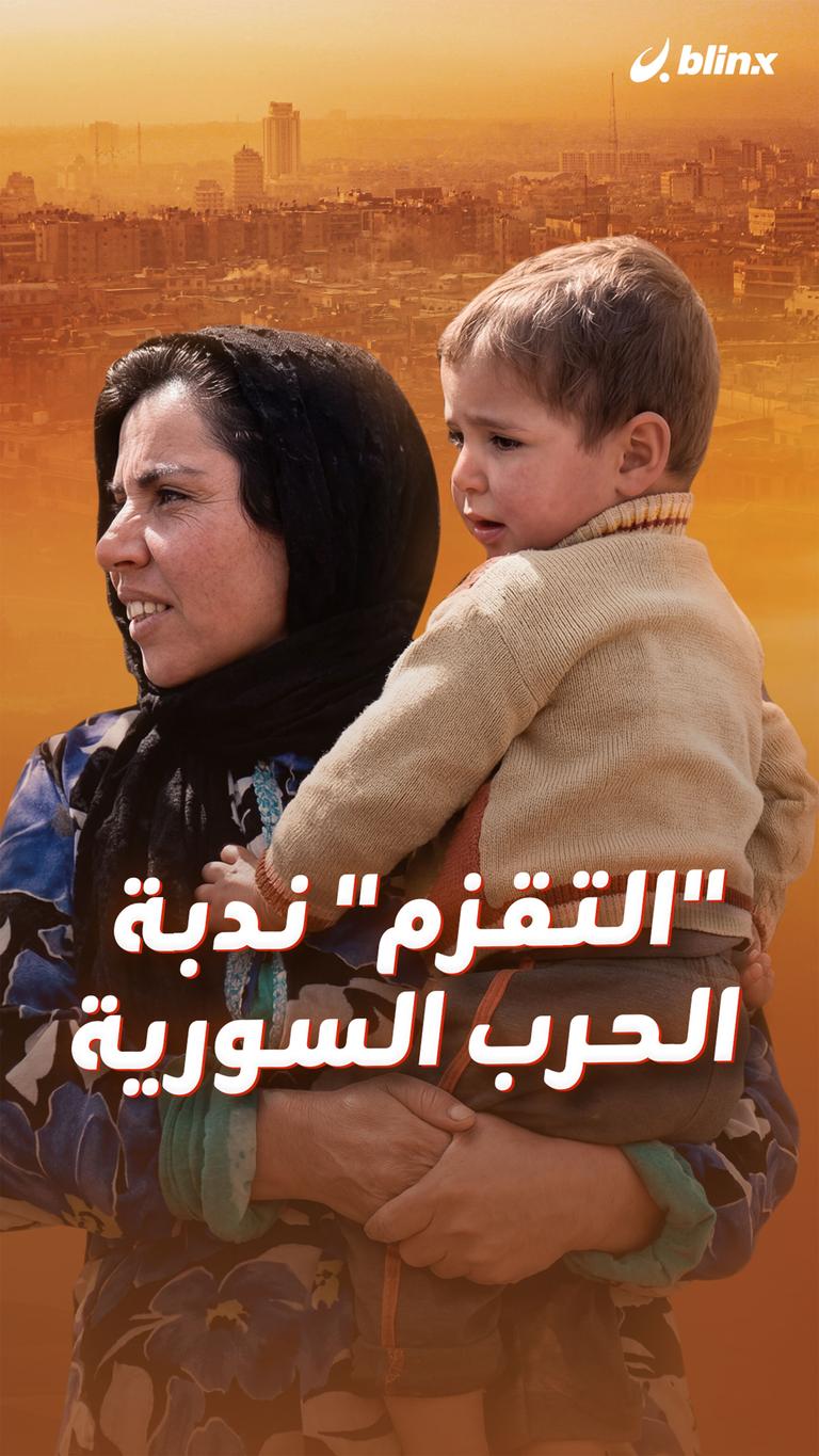 "التقزم" ندبة الحرب السورية