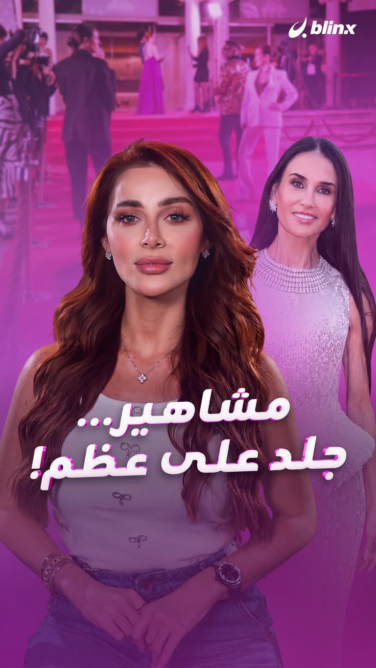 مشاهير...  جلد على عظم!
