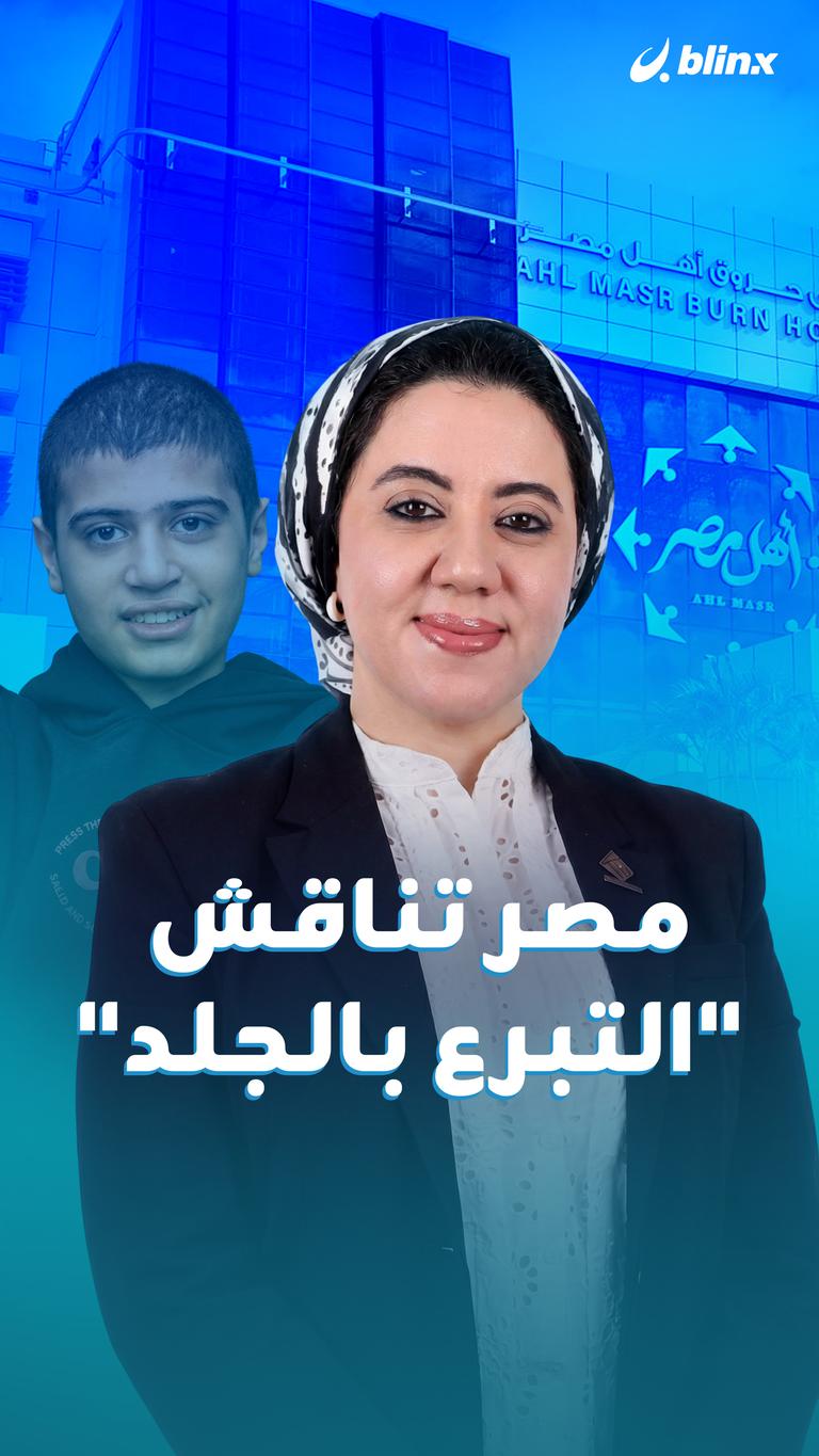 مصر تناقش "التبرع بالجلد"